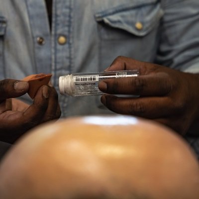 best hair systems for men in London