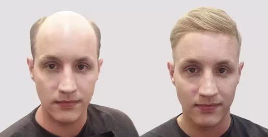 HAIR REPLACEMENT SYSTEMS AT COCHRANE & CO IN LONDON