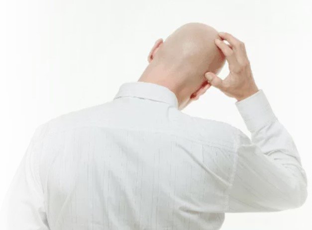Hair Replacement Systems for Bald Men London UK