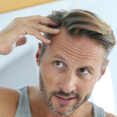 hair loss advice from Cochrane Co Salon in London Holborn 1