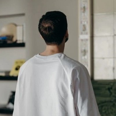 male replacement hair systems in london 1