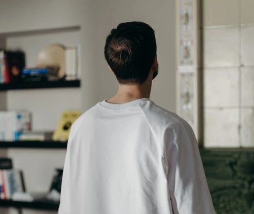 male replacement hair systems in london